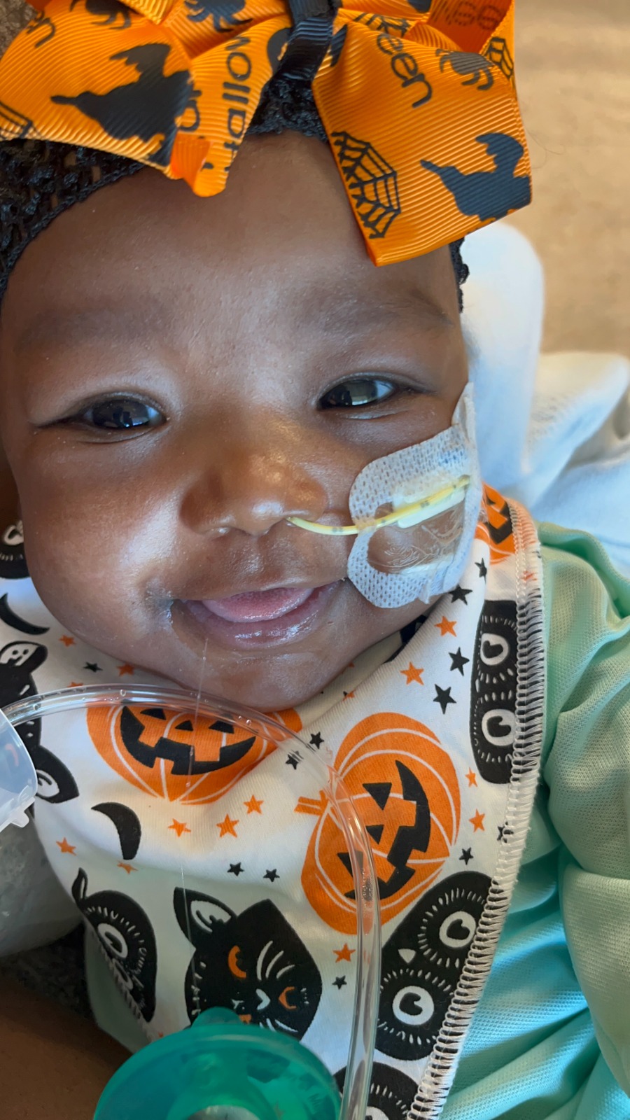 Renee smiling in Halloween outfit with feeding tube