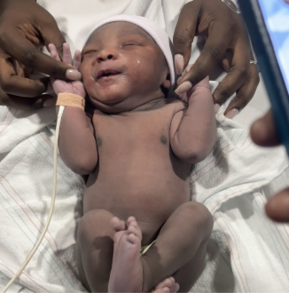 Newborn Renee moments after birth, being held by family hands